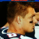 Illustration for article titled That Sure Looks Like A Pair Of Vicious Hickeys On Rob Gronkowskis Neck